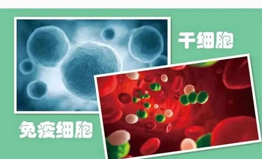 选择干细胞治疗还是免疫细胞治疗，你了解吗？