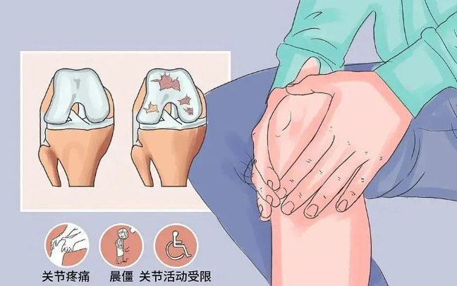 临床验证：干细胞治疗骨关节炎安全有效！
